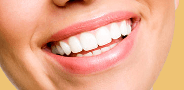 Smile Makeover Image